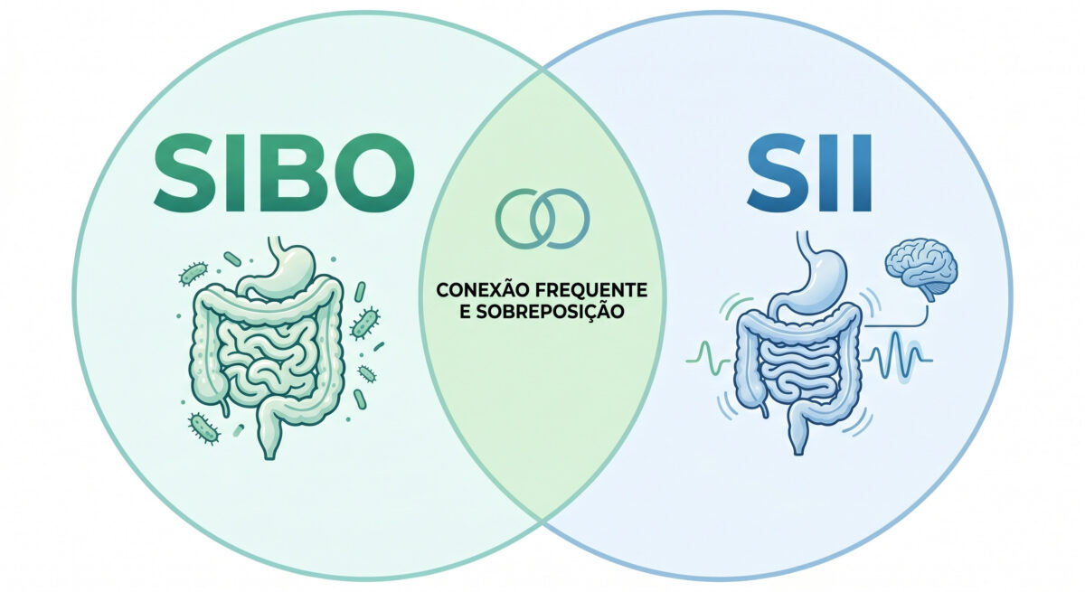 Diferença entre SIBO e SII em Sobre SIBO Diagrama de intersecção ilustrando a Diferença entre SIBO e SII e a conexão frequente entre estas condições digestivas.