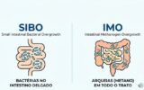 Qual a Diferença Entre SIBO e IMO? Tudo o Que Precisa Saber em Notícias Infográfico comparativo sobre a Diferença Entre SIBO e IMO. SIBO no intestino delgado, IMO em todo o trato.