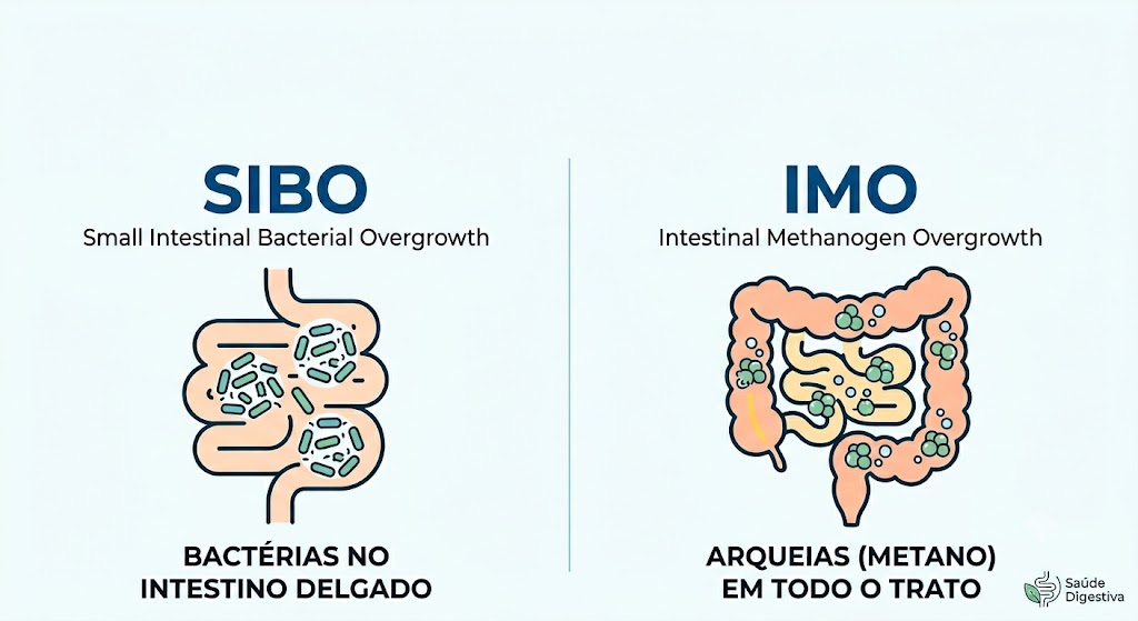 Qual a Diferença Entre SIBO e IMO? Tudo o Que Precisa Saber em Sobre SIBO Infográfico comparativo sobre a Diferença Entre SIBO e IMO. SIBO no intestino delgado, IMO em todo o trato.